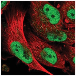ABCA1 Antibody, Novus Biologicals:Antibodies:Primary Antibodies