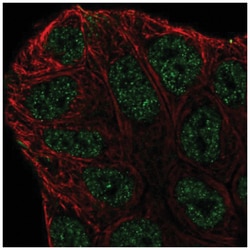 ABCA6 Antibody, Novus Biologicals:Antibodies:Primary Antibodies