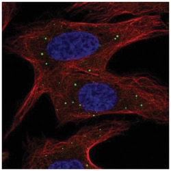 ABCB9 Antibody, Novus Biologicals 25 &mu;L:Antibodies, Polyclonal