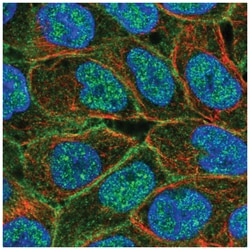 ABCC5 Antibody, Novus Biologicals:Antibodies:Primary Antibodies