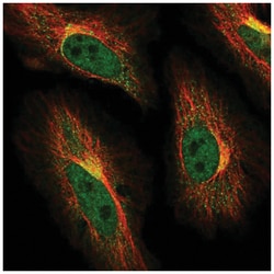 ABCG1 Antibody, Novus Biologicals:Antibodies:Primary Antibodies