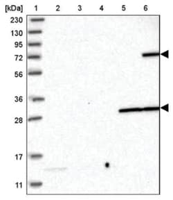 ABCG1 Antibody, Novus Biologicals 25 &mu;L:Antibodies, Polyclonal