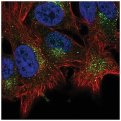 ABHD6 Antibody, Novus Biologicals:Antibodies:Primary Antibodies