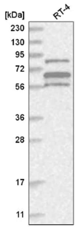ABI1 Antibody, Novus Biologicals 25 &mu;L:Antibodies, Polyclonal