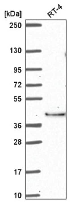 ABI2 Antibody, Novus Biologicals 25 &mu;L:Antibodies, Polyclonal