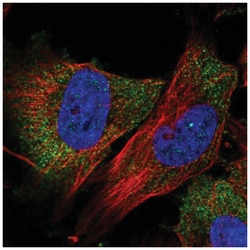 ABRO Antibody, Novus Biologicals:Antibodies:Primary Antibodies