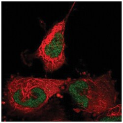 ABTB2 Antibody, Novus Biologicals 100&mu;L; Unlabeled:Antibodies, Polyclonal