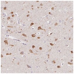 AC011484.2 Antibody, Novus Biologicals 25 &mu;L, Unlabeled:Antibodies,