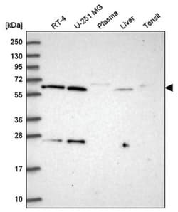 ACAD9 Antibody, Novus Biologicals:Antibodies:Primary Antibodies