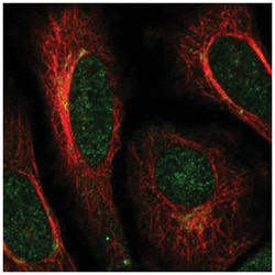 ACAP3 Antibody, Novus Biologicals 100&mu;L; Unlabeled:Antibodies, Polyclonal