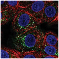 ACBD7 Antibody, Novus Biologicals 25 &mu;L, Unlabeled:Antibodies, Polyclonal