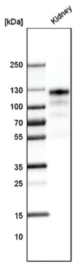 ACE-2 Antibody (CL4035), Novus Biologicals 100&mu;L; Unlabeled:Antibodies,