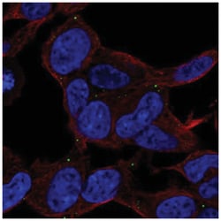 ACE/CD143 Antibody, Novus Biologicals:Antibodies:Primary Antibodies