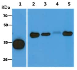 ACOT8 Mouse anti-Human, Clone: 4D10, Novus Biologicals:Antibodies:Primary