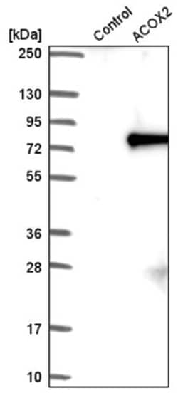 ACOX2 Antibody, Novus Biologicals 100&mu;L; Unlabeled:Antibodies, Polyclonal