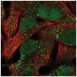 ACSBG1 Antibody, Novus Biologicals 100&mu;L; Unlabeled:Antibodies, Polyclonal