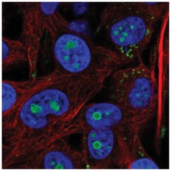 ACSL3 Antibody, Novus Biologicals 25 &mu;L; Unlabeled:Antibodies, Polyclonal