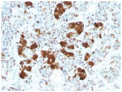 Beta-endorphin Mouse anti-Human, Clone-SPM501, Novus Biologicals 100&mu;g;
