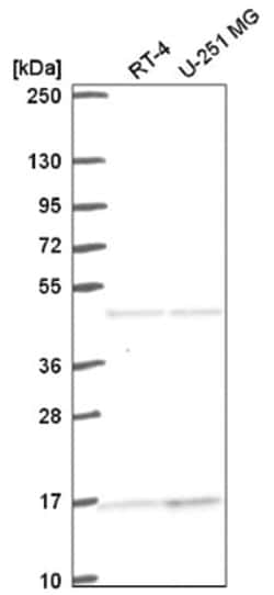 ACTR10 Antibody, Novus Biologicals 25 &mu;L:Antibodies, Polyclonal