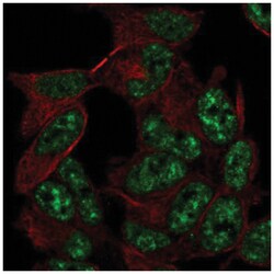 ADA2a Antibody, Novus Biologicals 25 &mu;L, Unlabeled:Antibodies, Polyclonal