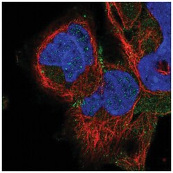 ADAM22 Antibody, Novus Biologicals 100&mu;L; Unlabeled:Antibodies, Polyclonal