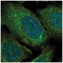 ADAM28 Antibody, Novus Biologicals:Antibodies:Primary Antibodies