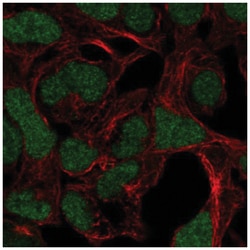ADAMTS17 Antibody, Novus Biologicals:Antibodies:Primary Antibodies