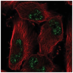 ADAMTS4 Antibody, Novus Biologicals 25 &mu;L; Unconjugated:Antibodies,