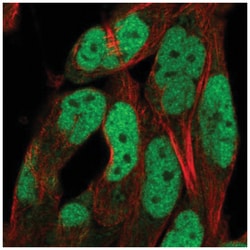 ADAMTS5 Antibody, Novus Biologicals 100&mu;L; Unlabeled:Antibodies, Polyclonal