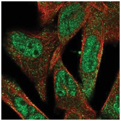 ADAMTS5 Antibody, Novus Biologicals 100&mu;L; Unlabeled:Antibodies, Polyclonal