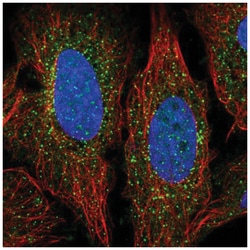 ADAMTS7 Antibody, Novus Biologicals 25 &mu;L:Antibodies, Polyclonal