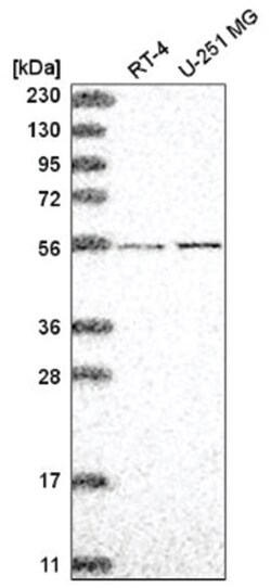 ADCK4 Antibody, Novus Biologicals 100&mu;L; Unlabeled:Antibodies, Polyclonal