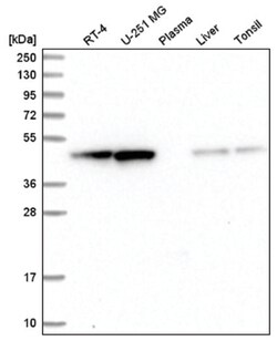 ADE2 Antibody, Novus Biologicals 25 &mu;L; Unlabeled:Antibodies, Polyclonal