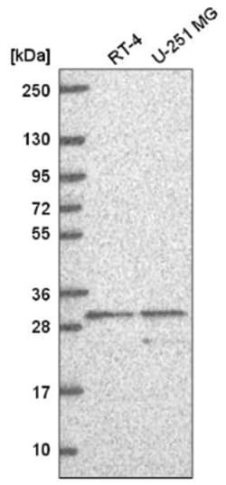 Adenine Nucleotide Translocator 2 Antibody, Novus Biologicals 100&mu;L;