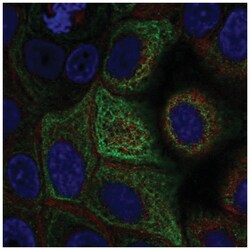 Adenylate Cyclase 5 Antibody, Novus Biologicals 100&mu;L; Unlabeled:Antibodies,