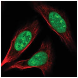 Adenylate Kinase 6 Antibody, Novus Biologicals:Antibodies:Primary Antibodies