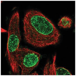 ADP-ribosylarginine hydrolase Antibody, Novus Biologicals 100 &mu;L | Buy Online | Novus Biologicals | Fisher Scientific