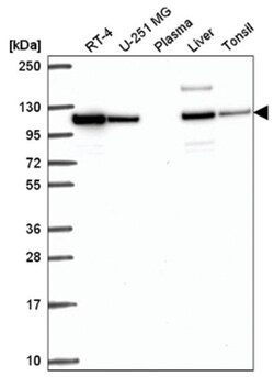 ADTB1 Antibody, Novus Biologicals:Antibodies:Primary Antibodies
