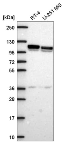 ADTB1 Antibody, Novus Biologicals:Antibodies:Primary Antibodies