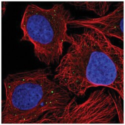 AE Binding Protein 1/ACLP Antibody, Novus Biologicals 25 &mu;L:Antibodies,