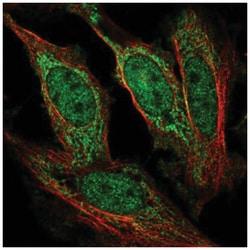 AF4 Antibody, Novus Biologicals 25 &mu;L, Unlabeled:Antibodies, Polyclonal