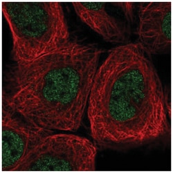 AGL Antibody, Novus Biologicals:Antibodies:Primary Antibodies