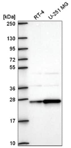 AGPAT1 Antibody, Novus Biologicals:Antibodies:Primary Antibodies