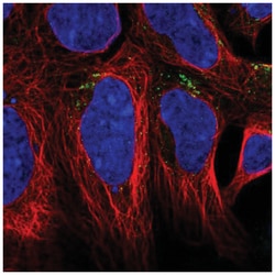 Agpat4 Antibody, Novus Biologicals 25 &mu;L, Unlabeled:Antibodies, Polyclonal