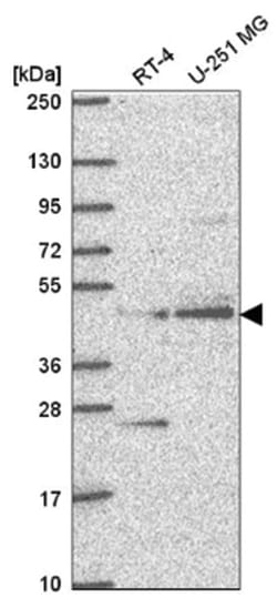 AGXT2L1 Antibody, Novus Biologicals 100 &mu;L | Buy Online | Novus Biologicals | Fisher Scientific