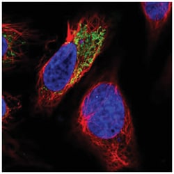 AGXT2L2 Antibody, Novus Biologicals 25 &mu;L, Unlabeled:Antibodies, Polyclonal