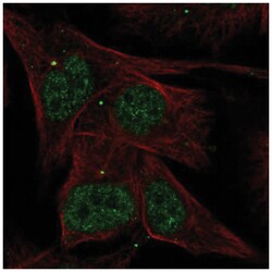 AKNA Antibody, Novus Biologicals 100&mu;L; Unlabeled:Antibodies, Polyclonal