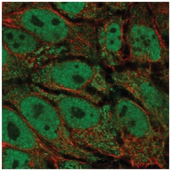 AKR1CL2 Antibody, Novus Biologicals 100&mu;L; Unlabeled:Antibodies, Polyclonal