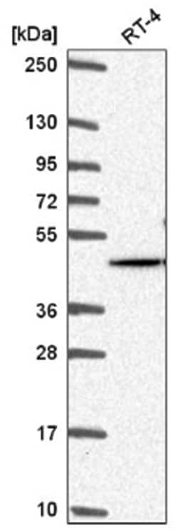 AKT2 Antibody, Novus Biologicals:Antibodies:Primary Antibodies