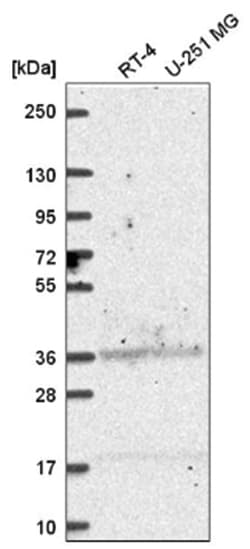Aldehyde Dehydrogenase 3-A1/ALDH3A1 Antibody, Novus Biologicals 100&mu;L;